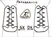 Rikybow-parabraccio-montaggio